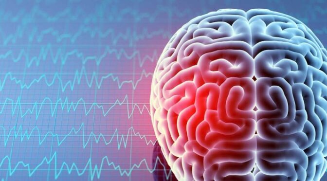 Brain Injury